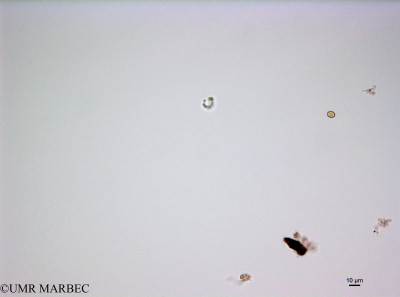 phyto/French_Polynesia/Moorea/PHYTOCONT June 2015/Nostocale 1 (ancien cyano2-150730_001_ovl-3).tif(copy)_thumb.jpg